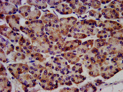 IHC image of the antibody diluted at 1:1200 and staining in paraffin-embedded human pancreatic tissue performed on a Leica BondTM system. After dewaxing and hydration, antigen retrieval was mediated by high pressure in a citrate buffer (pH 6.0). Section was blocked with 10% normal goat serum 30min at RT. Then primary antibody (1% BSA) was incubated at 4°C overnight. The primary is detected by a biotinylated secondary antibody and visualized using an HRP conjugated SP system.Rabbit anti-Human RAF1 Polyclonal Antibody
