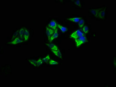 Immunofluorescence staining of Hela cells with the antibody at 1:200, counter-stained with DAPI. The cells were fixed in 4% formaldehyde, permeabilized using 0.2% Triton X-100 and blocked in 10% normal Goat Serum. The cells were then incubated with the antibody overnight at 4°C. The secondary antibody was Alexa Fluor 488-congugated AffiniPure Goat Anti-Rabbit IgG(H+L).Rabbit anti-Human RAP1A Polyclonal Antibody
