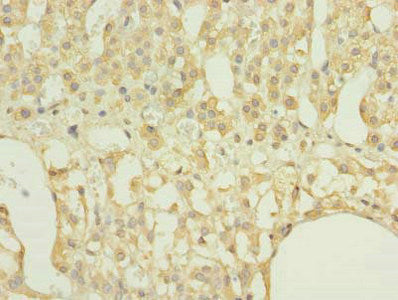 Immunohistochemistry of paraffin-embedded human adrenal gland tissue using RAP1A Antibody at dilution of 1:100Rabbit anti-Human RAP1A Polyclonal Antibody