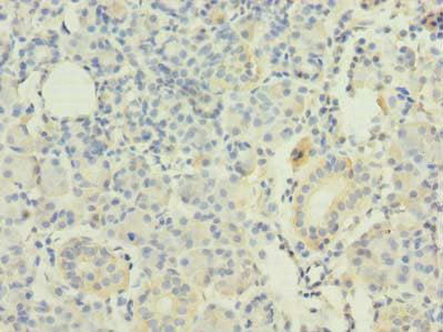 Immunohistochemistry of paraffin-embedded human pancreatic tissue using RAP1A Antibody at dilution of 1:100Rabbit anti-Human RAP1A Polyclonal Antibody