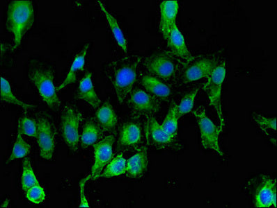 Immunofluorescent analysis of Hela cells using RARS Antibody at dilution of 1:100 and Alexa Fluor 488-congugated AffiniPure Goat Anti-Rabbit IgG(H+L)Rabbit anti-Human RARS Polyclonal Antibody