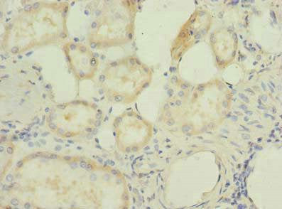 Immunohistochemistry of paraffin-embedded human kidney tissue using RBBP9 Antibody at dilution of 1:100Rabbit anti-Human RBBP9 Polyclonal Antibody