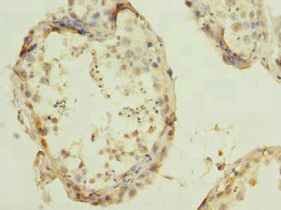 Immunohistochemistry of paraffin-embedded human testis tissue using RBBP9 Antibody at dilution of 1:100Rabbit anti-Human RBBP9 Polyclonal Antibody