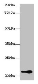 Western blot  | All lanes: RBBP9 antibody at 1µg/ml + A375 whole cell lysate  | Secondary  | Goat polyclonal to rabbit IgG at 1/10000 dilution  | Predicted band size: 21, 20 kDa  | Observed band size: 21 kDaRabbit anti-Human RBBP9 Polyclonal Antibody