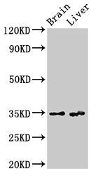 Western Blot  | Positive WB detected in: Rat brain tissue, Rat liver tissue  | All lanes: RBKS antibody at 3.4µg/ml  | Secondary  | Goat polyclonal to rabbit IgG at 1/50000 dilution  | Predicted band size: 35, 31 kDa  | Observed band size: 35 kDaRabbit anti-Human RBKS Polyclonal Antibody