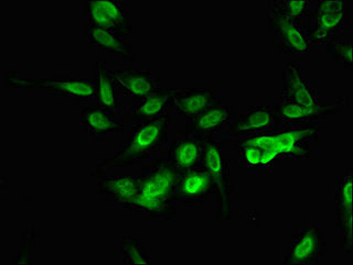 Immunofluorescent analysis of Hela cells using RBM10 Antibody at dilution of 1:100 and Alexa Fluor 488-congugated AffiniPure Goat Anti-Rabbit IgG(H+L)Rabbit anti-Human RBM10 Polyclonal Antibody