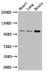 Western Blot  | Positive WB detected in: Mouse heart tissue, Mouse lung tissue, Mouse brain tissue  | All lanes: RBM10 antibody at 3µg/ml  | Secondary  | Goat polyclonal to rabbit IgG at 1/50000 dilution  | Predicted band size: 104, 95, 111 kDa  | Observed band size: 104 kDaRabbit anti-Human RBM10 Polyclonal Antibody