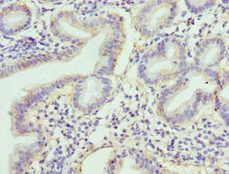 Immunohistochemistry of paraffin-embedded human duodenal tissue using RBP2 Antibody at dilution of 1:100Rabbit anti-Human RBP2 Polyclonal Antibody