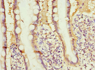 Immunohistochemistry of paraffin-embedded human small intestine tissue using RBP2 Antibody at dilution of 1:100Rabbit anti-Human RBP2 Polyclonal Antibody