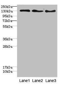 Western blot | All lanes: RBP2antibody at 1.76μg/ml | Lane 1: Hela whole cell lysate | Lane 2: HepG2 whole cell lysate | Lane 3: Jurkat whole cell lysate | Secondary | Goat polyclonal to rabbit IgG at 1/10000 dilution | Predicted band size: 192 kDa | Observed band size: 192 kDaRabbit anti-Human RBP2 Polyclonal Antibody