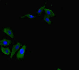 Immunofluorescent analysis of Hela cells using RBPJ Antibody at dilution of 1:100 and Alexa Fluor 488-congugated AffiniPure Goat Anti-Rabbit IgG(H+L)Rabbit anti-Human RBPJ Polyclonal Antibody