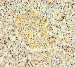 Immunohistochemistry of paraffin-embedded human pancreatic tissue using RBPJ Antibody at dilution of 1:100Rabbit anti-Human RBPJ Polyclonal Antibody