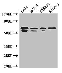 Western Blot | Positive WB detected in: Hela whole cell lysate, MCF-7 whole cell lysate, HEK293 whole cell lysate, Mouse kidney tissue | All lanes: RBPJ antibody at 3.5μg/ml | Secondary | Goat polyclonal to rabbit IgG at 1/50000 dilution | Predicted band size: 56, 48, 46, 55, 52 kDa | Observed band size: 56, 55 kDaRabbit anti-Human RBPJ Polyclonal Antibody