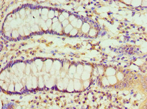 Immunohistochemistry of paraffin-embedded human colon tissue using RBX1 Antibody at dilution of 1:100Rabbit anti-Human RBX1 Polyclonal Antibody