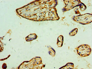 Immunohistochemistry of paraffin-embedded human placenta tissue using RBX1 Antibody at dilution of 1:100Rabbit anti-Human RBX1 Polyclonal Antibody