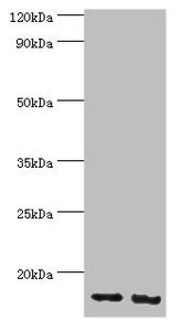 Western blot | All lanes: E3 ubiquitin-protein ligase RBX1 antibody at 4μg/ml | Lane 1: Hela whole cell lysate | Lane 2: HepG2 whole cell lysate | Secondary | Goat polyclonal to rabbit IgG at 1/10000 dilution | Predicted band size: 12 kDa | Observed band size: 12 kDaRabbit anti-Human RBX1 Polyclonal Antibody