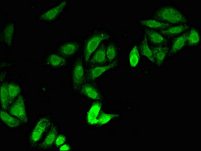 Immunofluorescent analysis of HepG2 cells using JAG1 Antibody at dilution of 1:100 and Alexa Fluor 488-congugated AffiniPure Goat Anti-Rabbit IgG(H+L)