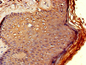 Immunohistochemistry of paraffin-embedded human skin tissue using RCBTB2 Antibody at dilution of 1:100Rabbit anti-Human RCBTB2 Polyclonal Antibody