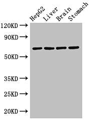Western Blot  | Positive WB detected in: HepG2 whole cell lysate, Rat liver tissue, Rat brain tissue, Rat stomach tissue  | All lanes: RCBTB2 antibody at 3.2µg/ml  | Secondary  | Goat polyclonal to rabbit IgG at 1/50000 dilution  | Predicted band size: 61, 58 kDa  | Observed band size: 61 kDaRabbit anti-Human RCBTB2 Polyclonal Antibody