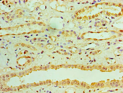 Immunohistochemistry of paraffin-embedded human kidney tissue using RDH11 Antibody at dilution of 1:100Rabbit anti-Human RDH11 Polyclonal Antibody