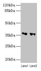 Western blot  | All lanes: RDH11 antibody at 10µg/ml  | Lane 1: PC-3 whole cell lysate  | Lane 2: Hela whole cell lysate  | Secondary  | Goat polyclonal to rabbit IgG at 1/10000 dilution  | Predicted band size: 36, 35, 28 kDa  | Observed band size: 36 kDaRabbit anti-Human RDH11 Polyclonal Antibody