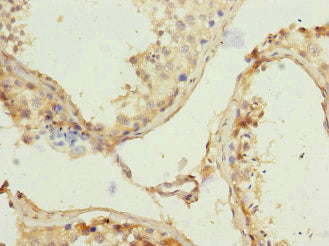 Immunohistochemistry of paraffin-embedded human testis tissue using REC8 Antibody at dilution of 1:100Rabbit anti-Human REC8 Polyclonal Antibody