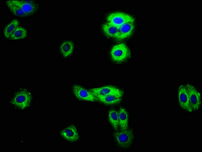 Immunofluorescence staining of HepG2 cells with RECK Antibody at 1:100, counter-stained with DAPI. The cells were fixed in 4% formaldehyde, permeabilized using 0.2% Triton X-100 and blocked in 10% normal Goat Serum. The cells were then incubated with the antibody overnight at 4°C. The secondary antibody was Alexa Fluor 488-congugated AffiniPure Goat Anti-Rabbit IgG(H+L).Rabbit anti-Human RECK Polyclonal Antibody
