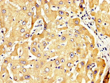 IHC image of the antibody diluted at 1:300 and staining in paraffin-embedded human liver tissue performed on a Leica BondTM system. After dewaxing and hydration, antigen retrieval was mediated by high pressure in a citrate buffer (pH 6.0). Section was blocked with 10% normal goat serum 30min at RT. Then primary antibody (1% BSA) was incubated at 4°C overnight. The primary is detected by a biotinylated secondary antibody and visualized using an HRP conjugated SP system.Rabbit anti-Human RECK Polyclonal Antibody