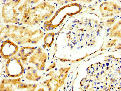 IHC image of RECK Antibody diluted at 1:300 and staining in paraffin-embedded human kidney tissue performed on a Leica BondTM system. After dewaxing and hydration, antigen retrieval was mediated by high pressure in a citrate buffer (pH 6.0). Section was blocked with 10% normal goat serum 30min at RT. Then primary antibody (1% BSA) was incubated at 4°C overnight. The primary is detected by a biotinylated secondary antibody and visualized using an HRP conjugated SP system.Rabbit anti-Human RECK Polyclonal Antibody