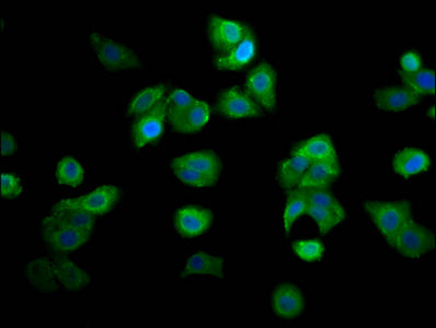 Immunofluorescence staining of HepG2 cells with RECQL4 Antibody at 1:166, counter-stained with DAPI. The cells were fixed in 4% formaldehyde, permeabilized using 0.2% Triton X-100 and blocked in 10% normal Goat Serum. The cells were then incubated with the antibody overnight at 4°C. The secondary antibody was Alexa Fluor 488-congugated AffiniPure Goat Anti-Rabbit IgG(H+L).Rabbit anti-Human RECQL4 Polyclonal Antibody