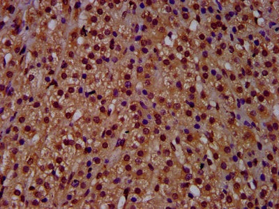 IHC image of RECQL4 Antibody diluted at 1:500 and staining in paraffin-embedded human adrenal gland tissue performed on a Leica BondTM system. After dewaxing and hydration, antigen retrieval was mediated by high pressure in a citrate buffer (pH 6.0). Section was blocked with 10% normal goat serum 30min at RT. Then primary antibody (1% BSA) was incubated at 4°C overnight. The primary is detected by a biotinylated secondary antibody and visualized using an HRP conjugated SP system.Rabbit anti-Human RECQL4 Polyclonal Antibody