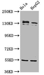 Western Blot  | Positive WB detected in: Hela whole cell lysate, HepG2 whole cell lysate  | All lanes: RECQL4 antibody at 4.8µg/ml  | Secondary  | Goat polyclonal to rabbit IgG at 1/50000 dilution  | Predicted band size: 134 kDa  | Observed band size: 134 kDaRabbit anti-Human RECQL4 Polyclonal Antibody