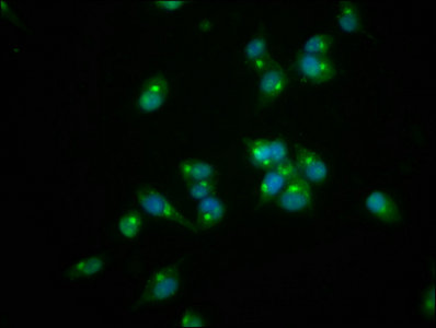 Immunofluorescence staining of SH-SY5Y cells with REG3A Antibody at 1:166, counter-stained with DAPI. The cells were fixed in 4% formaldehyde, permeabilized using 0.2% Triton X-100 and blocked in 10% normal Goat Serum. The cells were then incubated with the antibody overnight at 4°C. The secondary antibody was Alexa Fluor 488-congugated AffiniPure Goat Anti-Rabbit IgG(H+L).Rabbit anti-Human REG3A Polyclonal Antibody