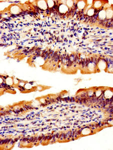 IHC image of the antibody diluted at 1:500 and staining in paraffin-embedded human small intestine tissue performed on a Leica BondTM system. After dewaxing and hydration, antigen retrieval was mediated by high pressure in a citrate buffer (pH 6.0). Section was blocked with 10% normal goat serum 30min at RT. Then primary antibody (1% BSA) was incubated at 4°C overnight. The primary is detected by a biotinylated secondary antibody and visualized using an HRP conjugated SP system.Rabbit anti-Human REG3A Polyclonal Antibody