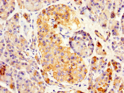 IHC image of REG3A Antibody diluted at 1:500 and staining in paraffin-embedded human pancreatic tissue performed on a Leica BondTM system. After dewaxing and hydration, antigen retrieval was mediated by high pressure in a citrate buffer (pH 6.0). Section was blocked with 10% normal goat serum 30min at RT. Then primary antibody (1% BSA) was incubated at 4°C overnight. The primary is detected by a biotinylated secondary antibody and visualized using an HRP conjugated SP system.Rabbit anti-Human REG3A Polyclonal Antibody