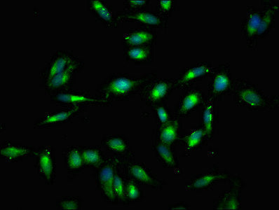 Immunofluorescent analysis of Hela cells using RELB Antibody at dilution of 1:100 and Alexa Fluor 488-congugated AffiniPure Goat Anti-Rabbit IgG(H+L)Rabbit anti-Human RELB Polyclonal Antibody