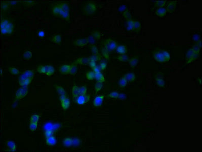 Immunofluorescent analysis of 293T cells using RER1 Antibody at dilution of 1:100 and Alexa Fluor 488-congugated AffiniPure Goat Anti-Rabbit IgG(H+L)Rabbit anti-Human RER1 Polyclonal Antibody
