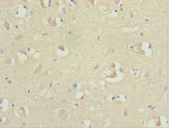 Immunohistochemistry of paraffin-embedded human brain tissue using RFPL2 Antibody at dilution of 1:100Rabbit anti-Human RFPL2 Polyclonal Antibody