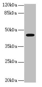 Western blot  | All lanes: RFPL2 antibody at 3.36µg/ml + MCF-7 whole cell lysate  | Secondary  | Goat polyclonal to rabbit IgG at 1/10000 dilution  | Predicted band size: 43, 33, 36 kDa  | Observed band size: 43 kDaRabbit anti-Human RFPL2 Polyclonal Antibody