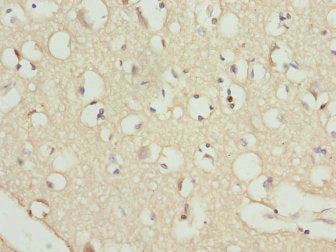 Immunohistochemistry of paraffin-embedded human brain tissue using RFPL2 Antibody at dilution of 1:100Rabbit anti-Human RFPL2 Polyclonal Antibody