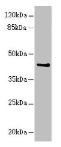 Western blot  | All lanes: RFPL2 antibody at 3.41µg/ml + MCF-7 whole cell lysate  | Secondary  | Goat polyclonal to rabbit IgG at 1/10000 dilution  | Predicted band size: 43, 33, 36 kDa  | Observed band size: 43 kDaRabbit anti-Human RFPL2 Polyclonal Antibody