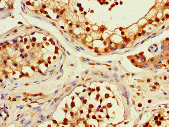 Immunohistochemistry of paraffin-embedded human testis tissue using the antibody at dilution of 1:100Rabbit anti-Human RFPL4B Polyclonal Antibody