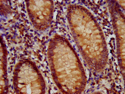IHC image of RFX1 Antibody diluted at 1:700 and staining in paraffin-embedded human appendix tissue performed on a Leica BondTM system. After dewaxing and hydration, antigen retrieval was mediated by high pressure in a citrate buffer (pH 6.0). Section was blocked with 10% normal goat serum 30min at RT. Then primary antibody (1% BSA) was incubated at 4°C overnight. The primary is detected by a biotinylated secondary antibody and visualized using an HRP conjugated SP system.Rabbit anti-Human RFX1 Polyclonal Antibody