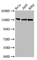 Western Blot | Positive WB detected in: Hela whole cell lysate, 293T whole cell lysate, K562 whole cell lysate | All lanes: RFX1 antibody at 3μg/ml | Secondary | Goat polyclonal to rabbit IgG at 1/50000 dilution | Predicted band size: 105 kDa | Observed band size: 105 kDaRabbit anti-Human RFX1 Polyclonal Antibody