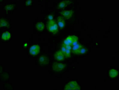 Immunofluorescence staining of MCF-7 cells with RFX2 Antibody at 1:200, counter-stained with DAPI. The cells were fixed in 4% formaldehyde, permeabilized using 0.2% Triton X-100 and blocked in 10% normal Goat Serum. The cells were then incubated with the antibody overnight at 4°C. The secondary antibody was Alexa Fluor 488-congugated AffiniPure Goat Anti-Rabbit IgG(H+L).Rabbit anti-Human RFX2 Polyclonal Antibody