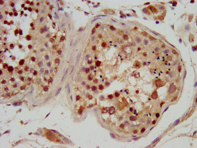 IHC image of the antibody diluted at 1:600 and staining in paraffin-embedded human testis tissue performed on a Leica BondTM system. After dewaxing and hydration, antigen retrieval was mediated by high pressure in a citrate buffer (pH 6.0). Section was blocked with 10% normal goat serum 30min at RT. Then primary antibody (1% BSA) was incubated at 4°C overnight. The primary is detected by a biotinylated secondary antibody and visualized using an HRP conjugated SP system.Rabbit anti-Human RFX2 Polyclonal Antibody