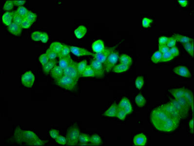 Immunofluorescence staining of PC-3 cells with RFXANK Antibody at 1:133, counter-stained with DAPI. The cells were fixed in 4% formaldehyde, permeabilized using 0.2% Triton X-100 and blocked in 10% normal Goat Serum. The cells were then incubated with the antibody overnight at 4°C. The secondary antibody was Alexa Fluor 488-congugated AffiniPure Goat Anti-Rabbit IgG(H+L).Rabbit anti-Human RFXANK Polyclonal Antibody