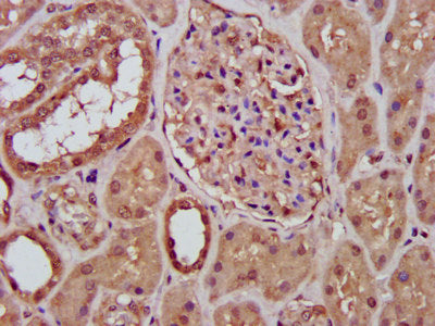 IHC image of RFXANK Antibody diluted at 1:400 and staining in paraffin-embedded human kidney tissue performed on a Leica BondTM system. After dewaxing and hydration, antigen retrieval was mediated by high pressure in a citrate buffer (pH 6.0). Section was blocked with 10% normal goat serum 30min at RT. Then primary antibody (1% BSA) was incubated at 4°C overnight. The primary is detected by a biotinylated secondary antibody and visualized using an HRP conjugated SP system.Rabbit anti-Human RFXANK Polyclonal Antibody