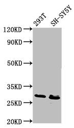 Western Blot | Positive WB detected in: 293T whole cell lysate, SH-SY5Y whole cell lysate | All lanes: RFXANK antibody at 6.7μg/ml | Secondary | Goat polyclonal to rabbit IgG at 1/50000 dilution | Predicted band size: 29, 25, 26 kDa | Observed band size: 29 kDaRabbit anti-Human RFXANK Polyclonal Antibody