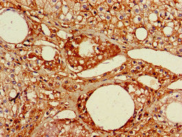 Immunohistochemistry of paraffin-embedded human adrenal gland tissue using RGL2 Antibody at dilution of 1:100